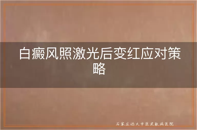 白癜风照激光后变红应对策略