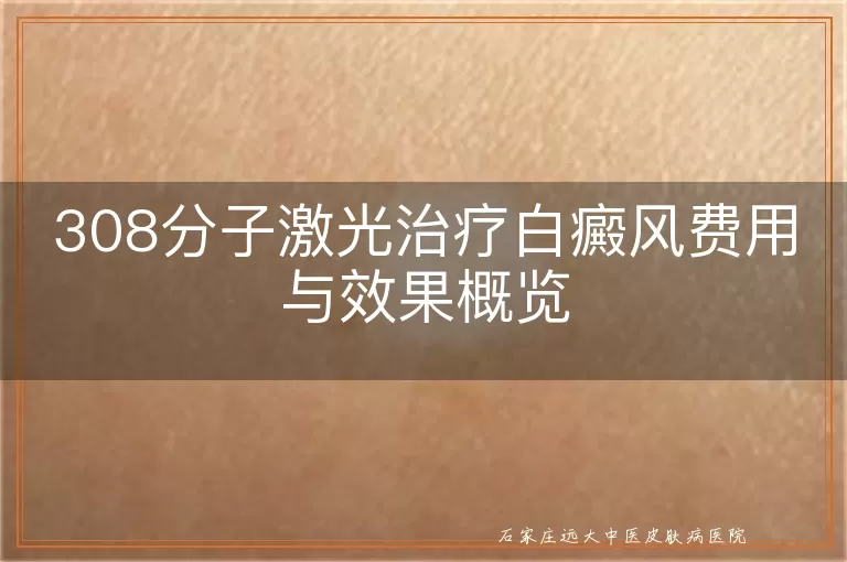 308分子激光治疗白癜风费用与效果概览