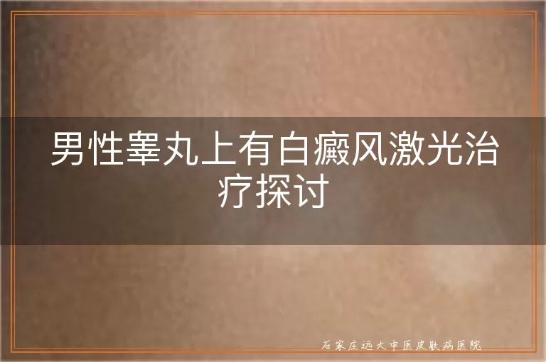 男性睾丸上有白癜风激光治疗探讨