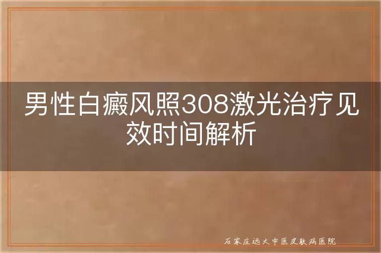 男性白癜风照308激光治疗见效时间解析