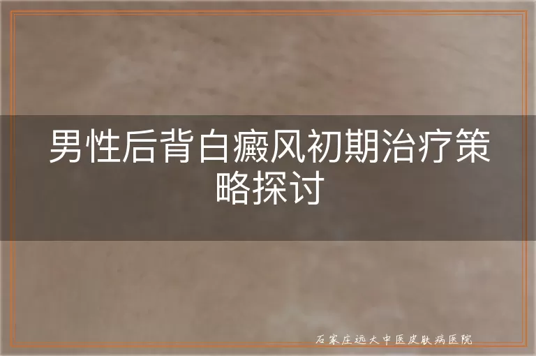 男性后背白癜风初期治疗策略探讨