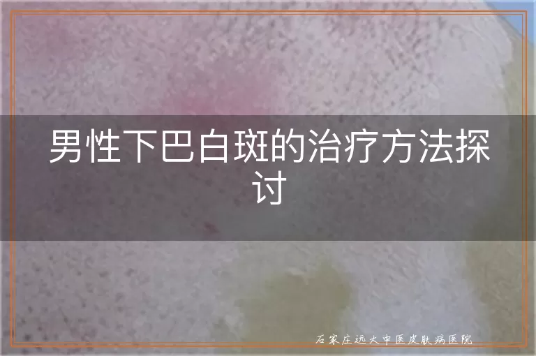 男性下巴白斑的治疗方法探讨