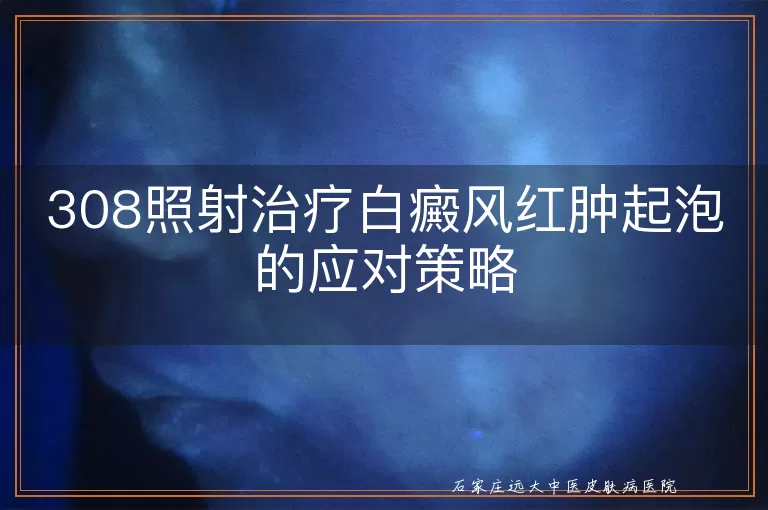 308照射治疗白癜风红肿起泡的应对策略
