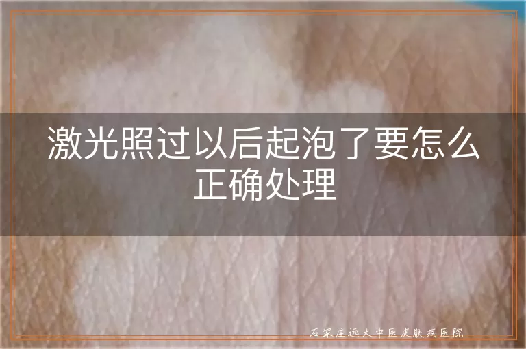 激光照过以后起泡了要怎么正确处理