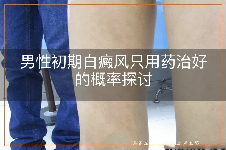 男性初期白癜风只用药治好的概率探讨