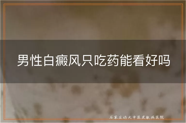 男性白癜风只吃药能看好吗