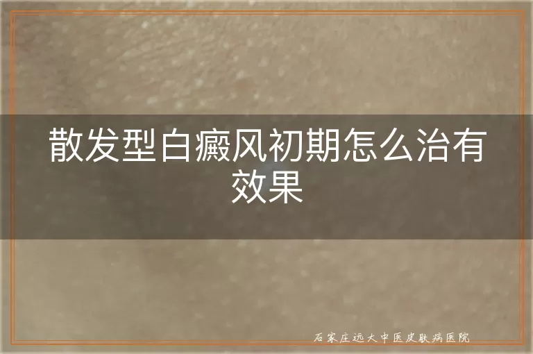 散发型白癜风初期怎么治有效果