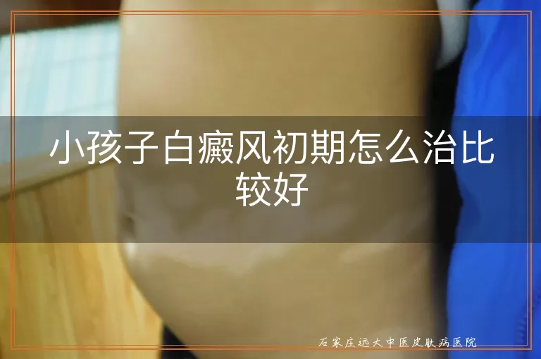小孩子白癜风初期怎么治比较好