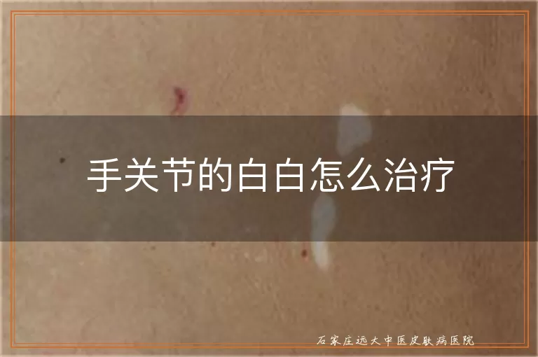 手关节的白白怎么治疗