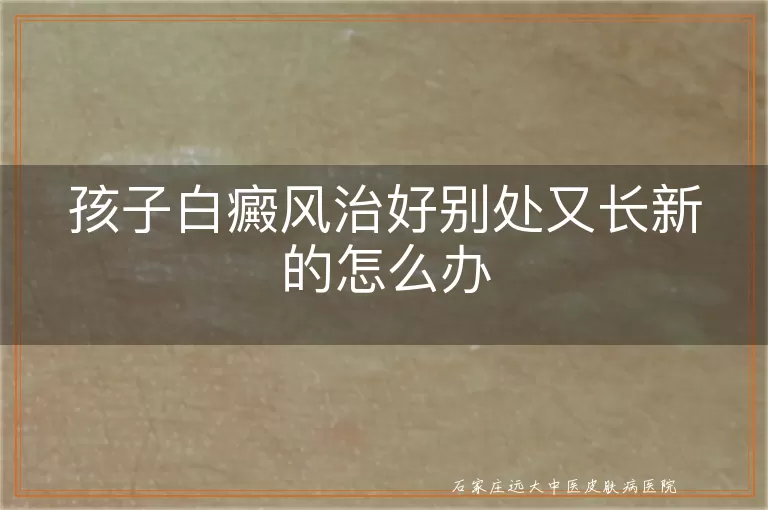 孩子白癜风治好别处又长新的怎么办