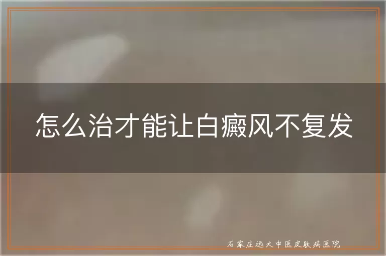 怎么治才能让白癜风不复发