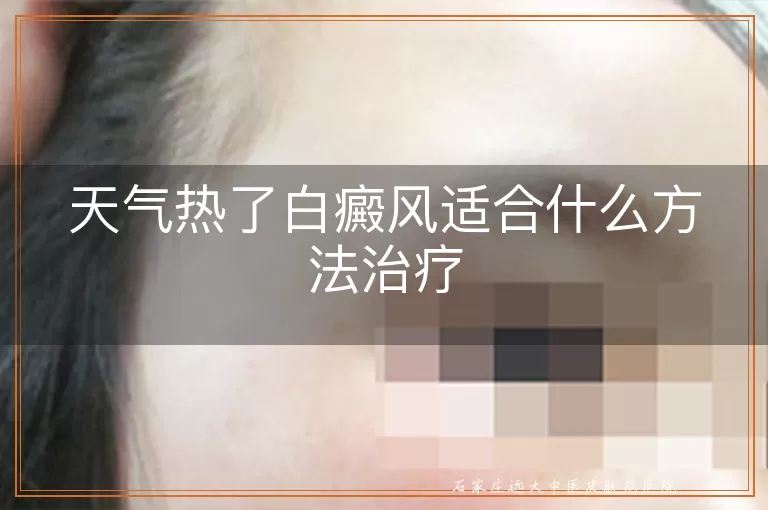 天气热了白癜风适合什么方法治疗