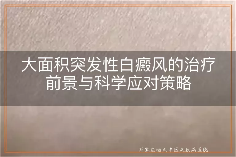 大面积突发性白癜风的治疗前景与科学应对策略