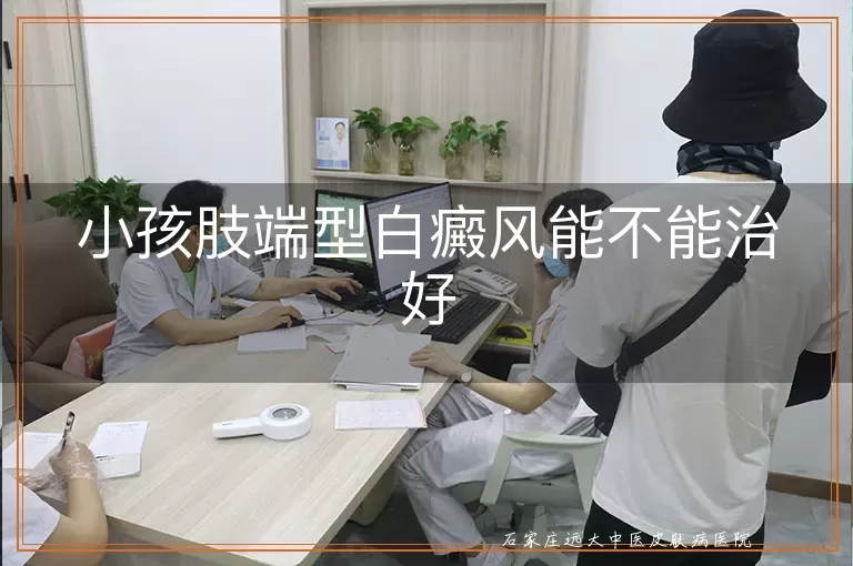 小孩肢端型白癜风能不能治好