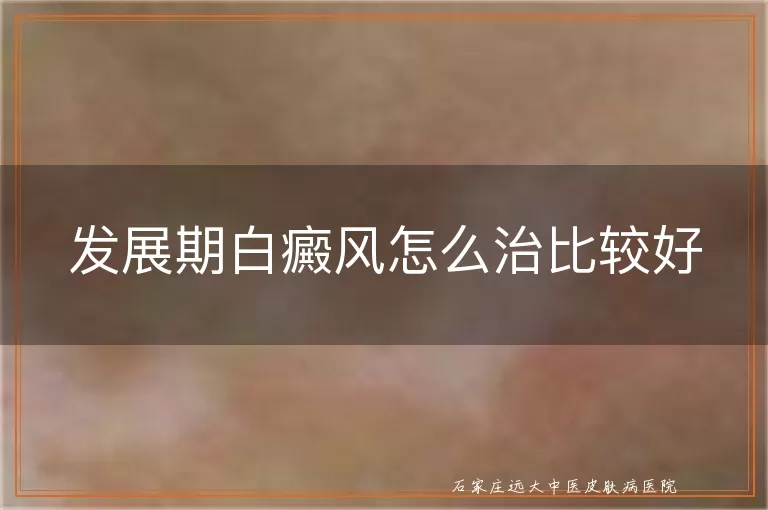 发展期白癜风怎么治比较好