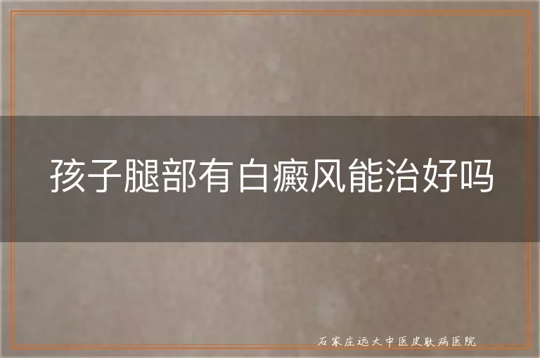 孩子腿部有白癜风能治好吗