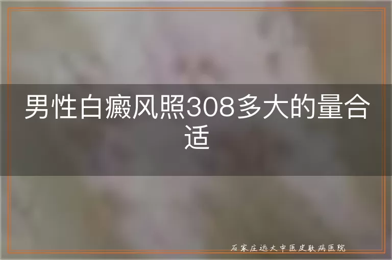 男性白癜风照308多大的量合适
