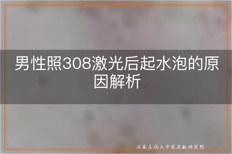 男性照308激光后起水泡的原因解析