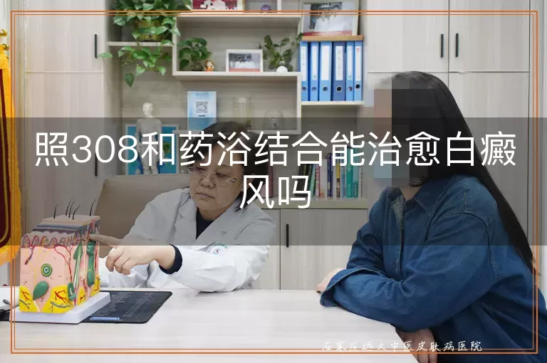 照308和药浴结合能治愈白癜风吗
