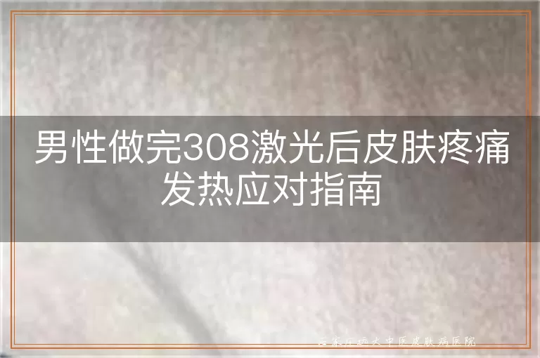 男性做完308激光后皮肤疼痛发热应对指南