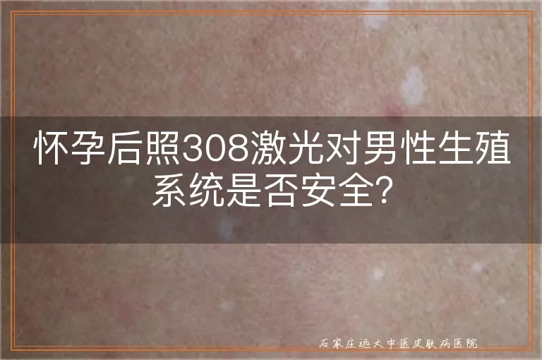 怀孕后照308激光对男性生殖系统是否安全？