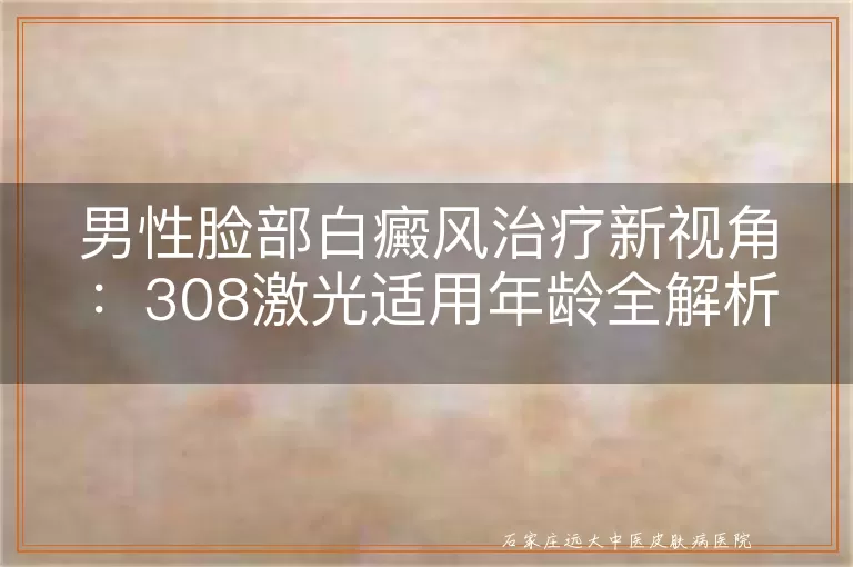 男性脸部白癜风治疗新视角：308激光适用年龄全解析