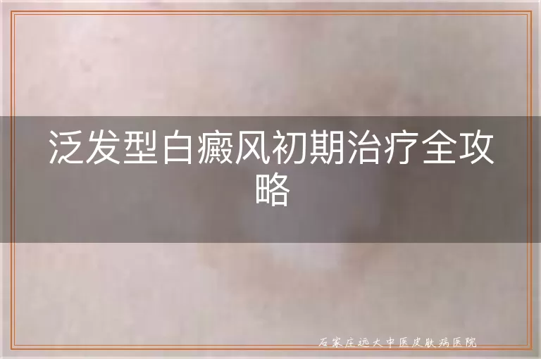 泛发型白癜风初期治疗全攻略