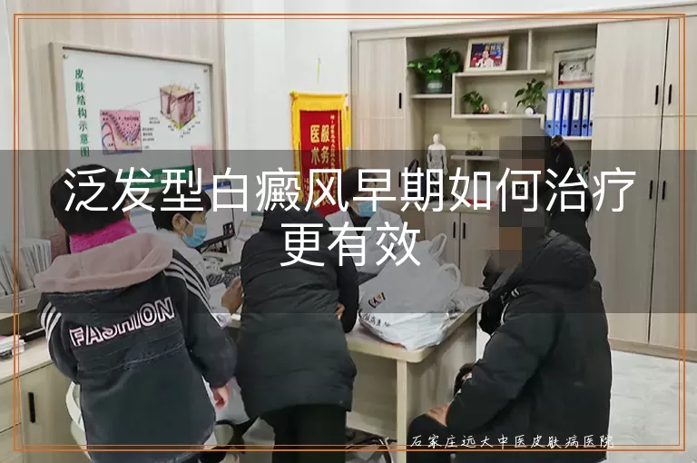 泛发型白癜风早期如何治疗更有效