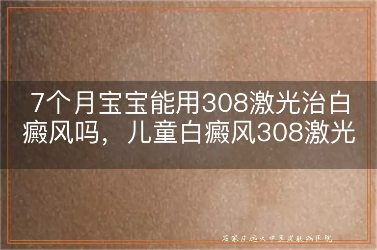 7个月宝宝能用308激光治白癜风吗，儿童白癜风308激光治疗解析