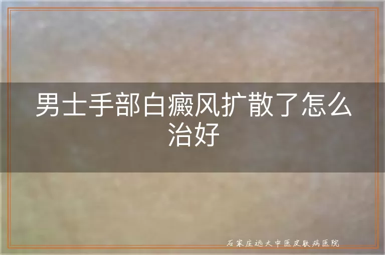 男士手部白癜风扩散了怎么治好