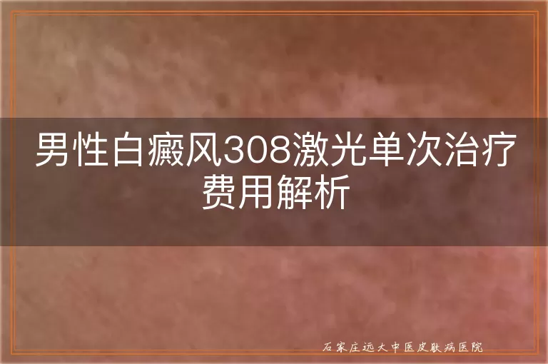 男性白癜风308激光单次治疗费用解析