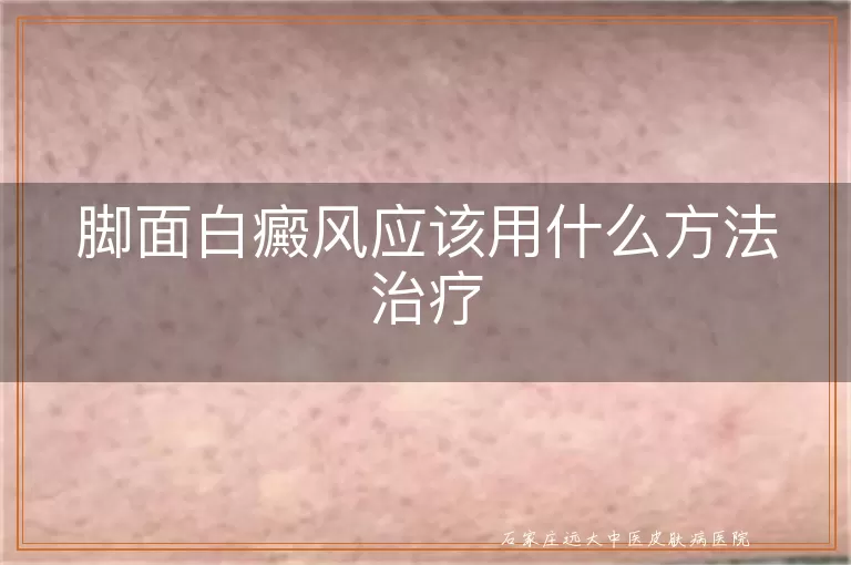 脚面白癜风应该用什么方法治疗