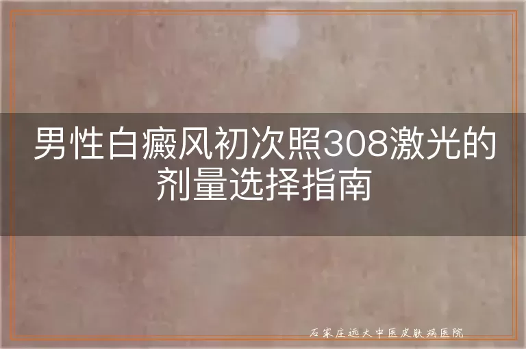 男性白癜风初次照308激光的剂量选择指南