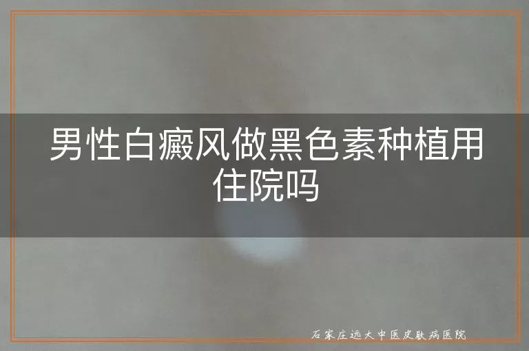 男性白癜风做黑色素种植用住院吗