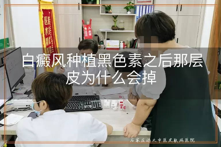 白癜风种植黑色素之后那层皮为什么会掉