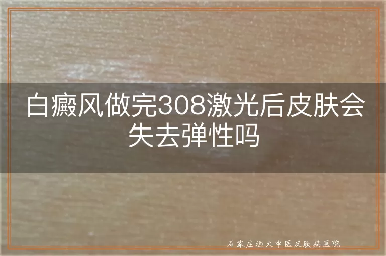 白癜风做完308激光后皮肤会失去弹性吗