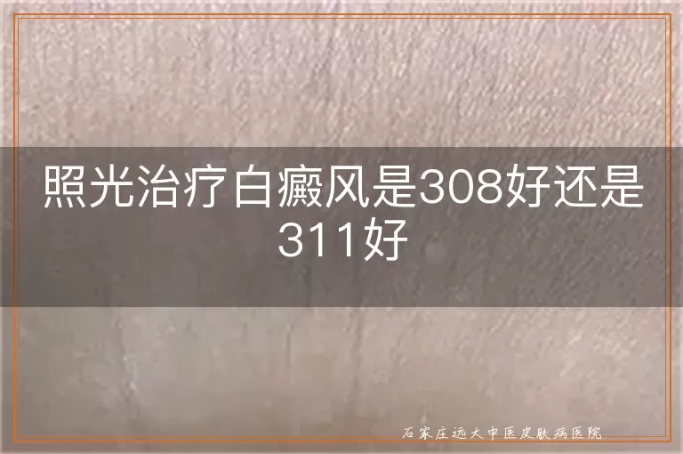照光治疗白癜风是308好还是311好