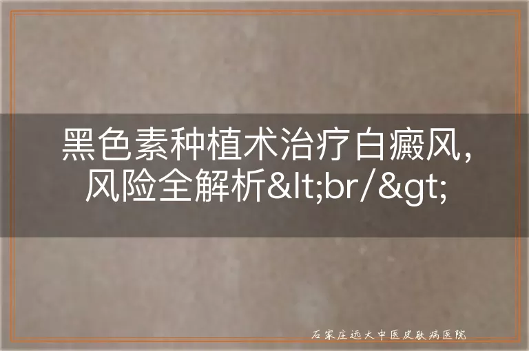 黑色素种植术治疗白癜风，风险全解析<br/>