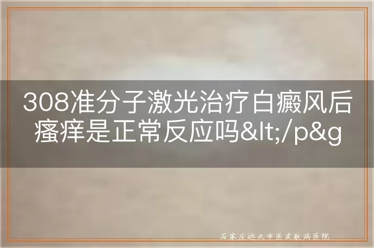 308准分子激光治疗白癜风后瘙痒是正常反应吗</p>
<p>