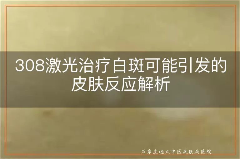 308激光治疗白斑可能引发的皮肤反应解析