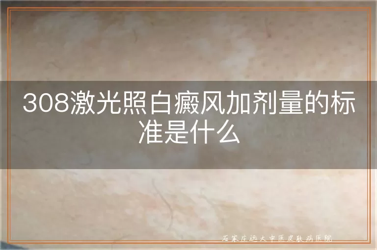 308激光照白癜风加剂量的标准是什么