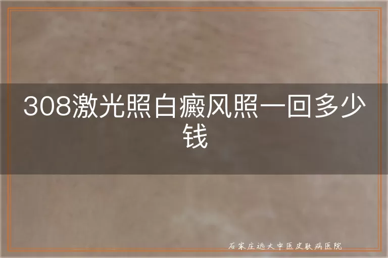 308激光照白癜风照一回多少钱