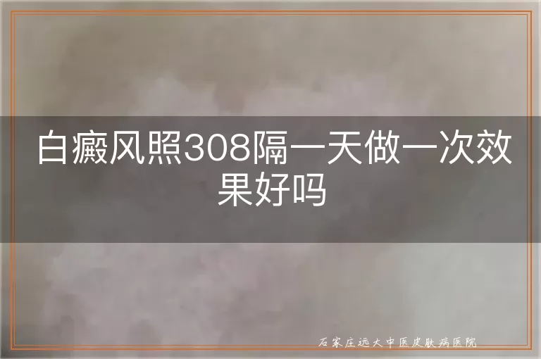 白癜风照308隔一天做一次效果好吗