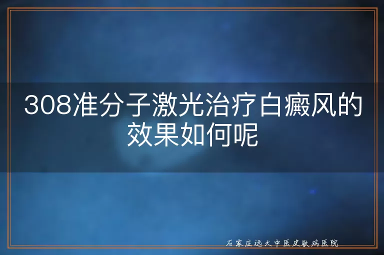 308准分子激光治疗白癜风的效果如何呢