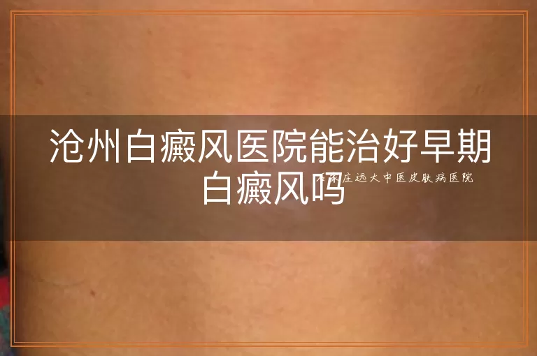 石家庄男性白癜风医院能治好早期白癜风吗