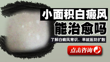 石家庄男性白癜风后期有什么不同的特征表现