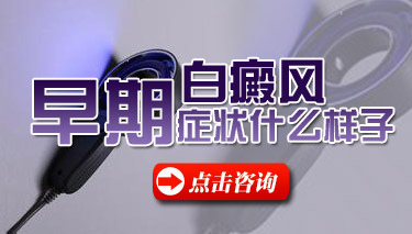 石家庄男性白癜风和其它皮肤疾病相比哪里不同