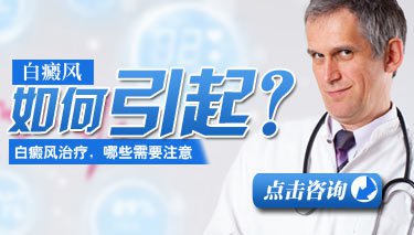 怎么去用眼睛来诊断白癜风呢