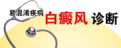 被太阳晒伤会导致白癜风吗