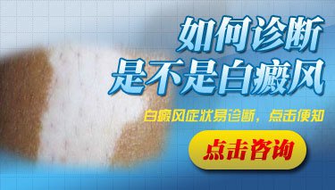 白癜风初期治疗有哪些益处